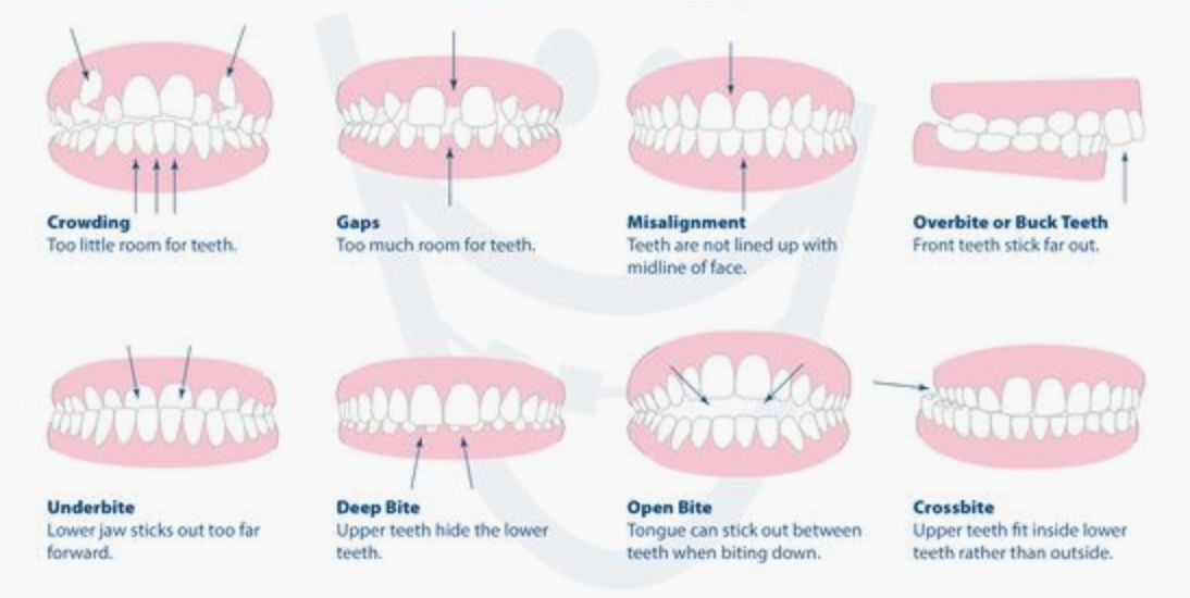 Carpinello Orthodontics Content